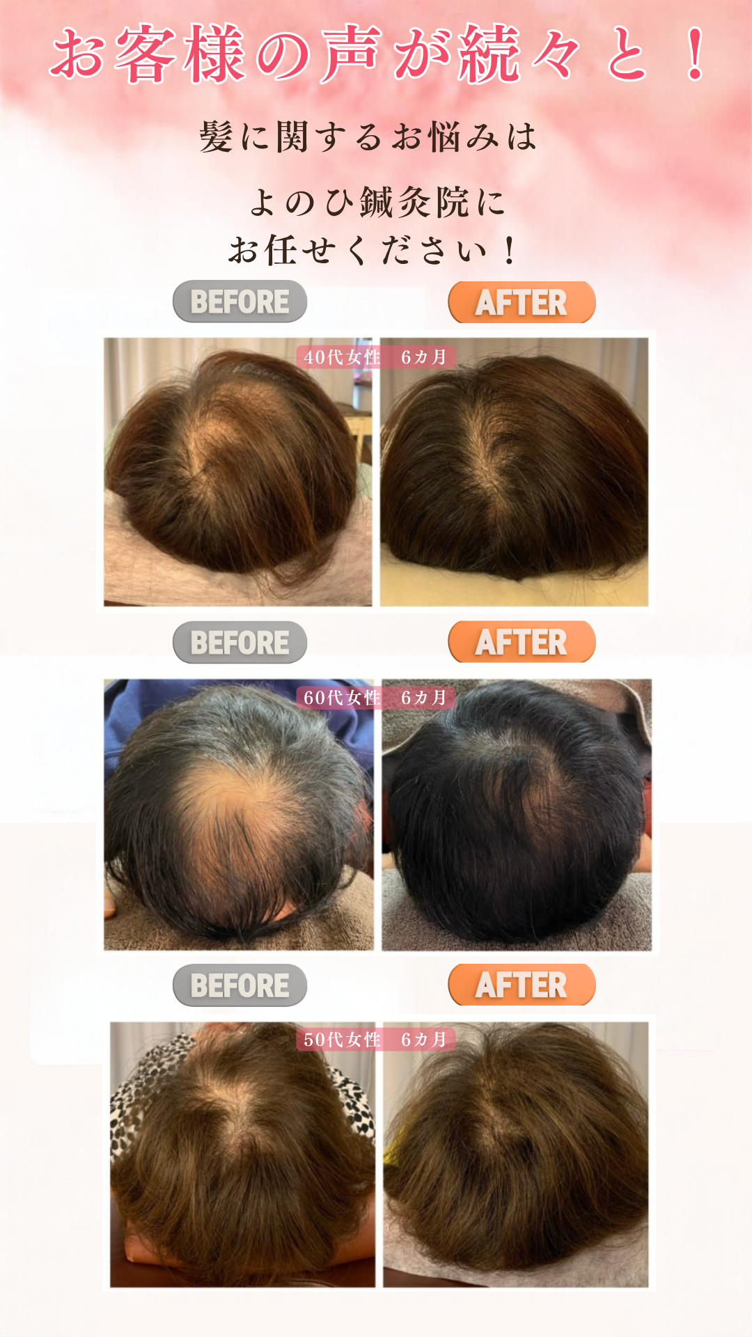 ビフォーアフター1